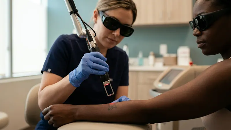 Clinician treating a tattoo on deeply pigmented skin with a 1064 nm laser handpiece and skin cooling
